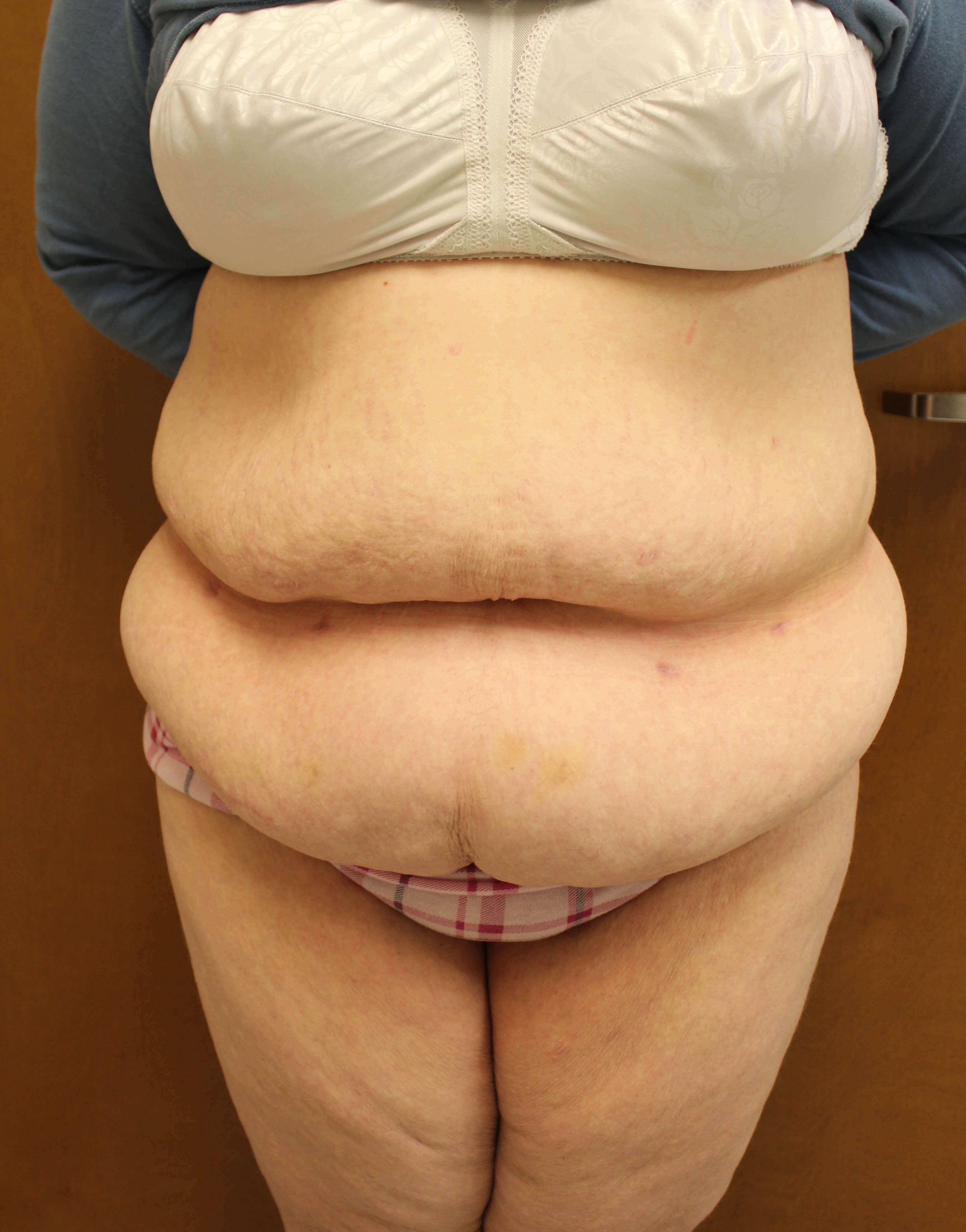 Before Image