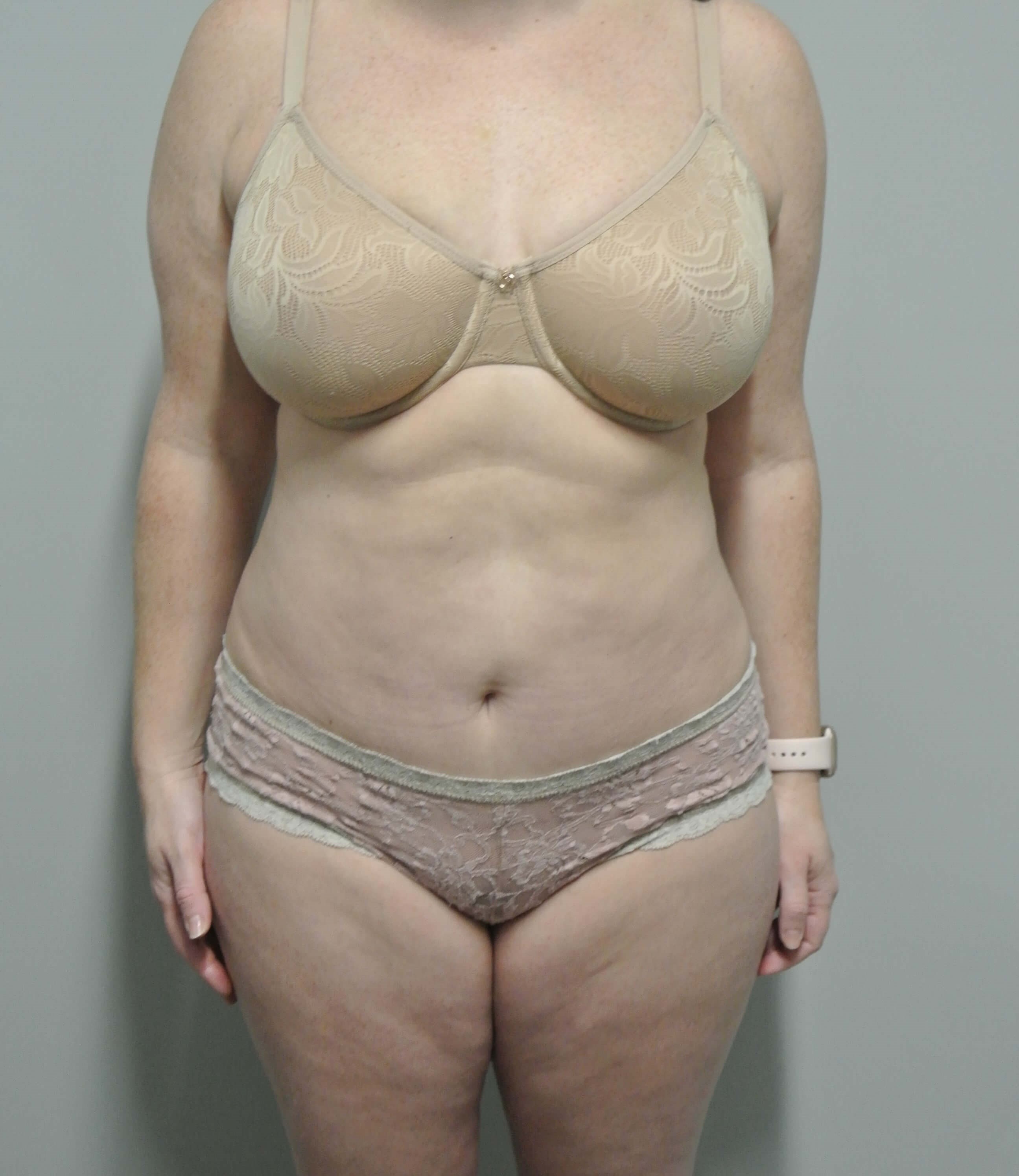 After Image