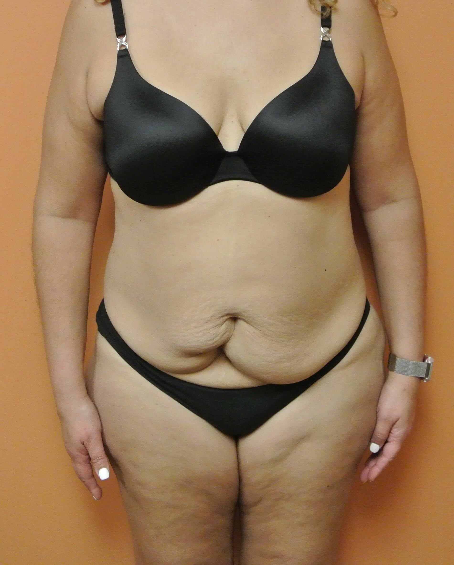 Before Image