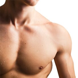 Gynecomastia
