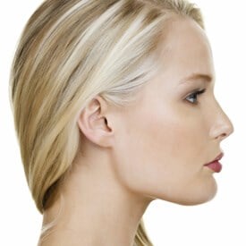 Neck Lift